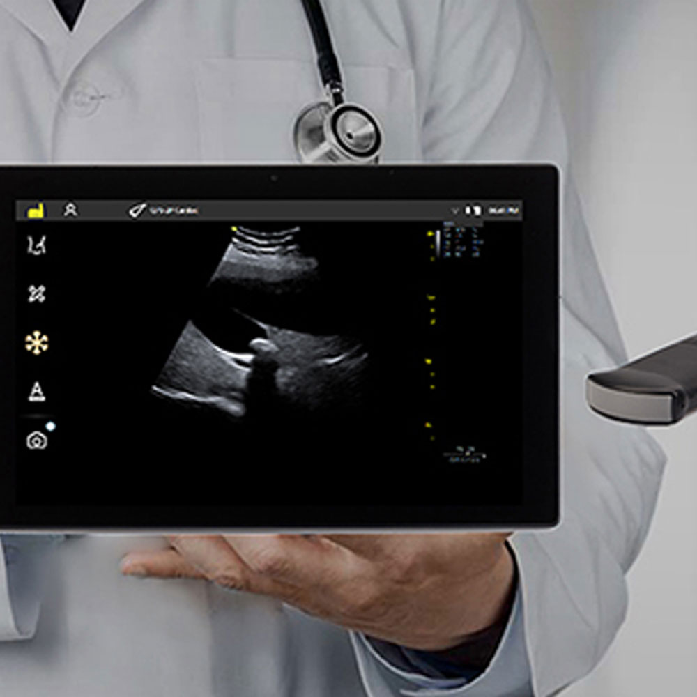 VINNO Launches the World’s First IPX7 Waterproof Handheld Ultrasound System